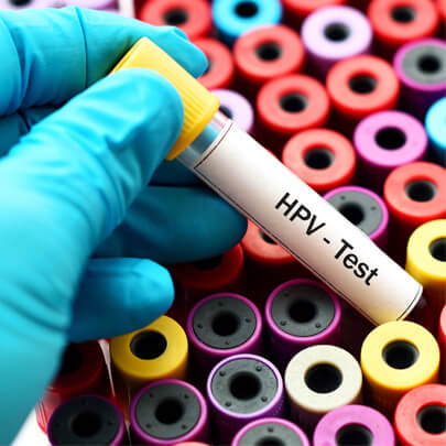 hpv-test-tnb